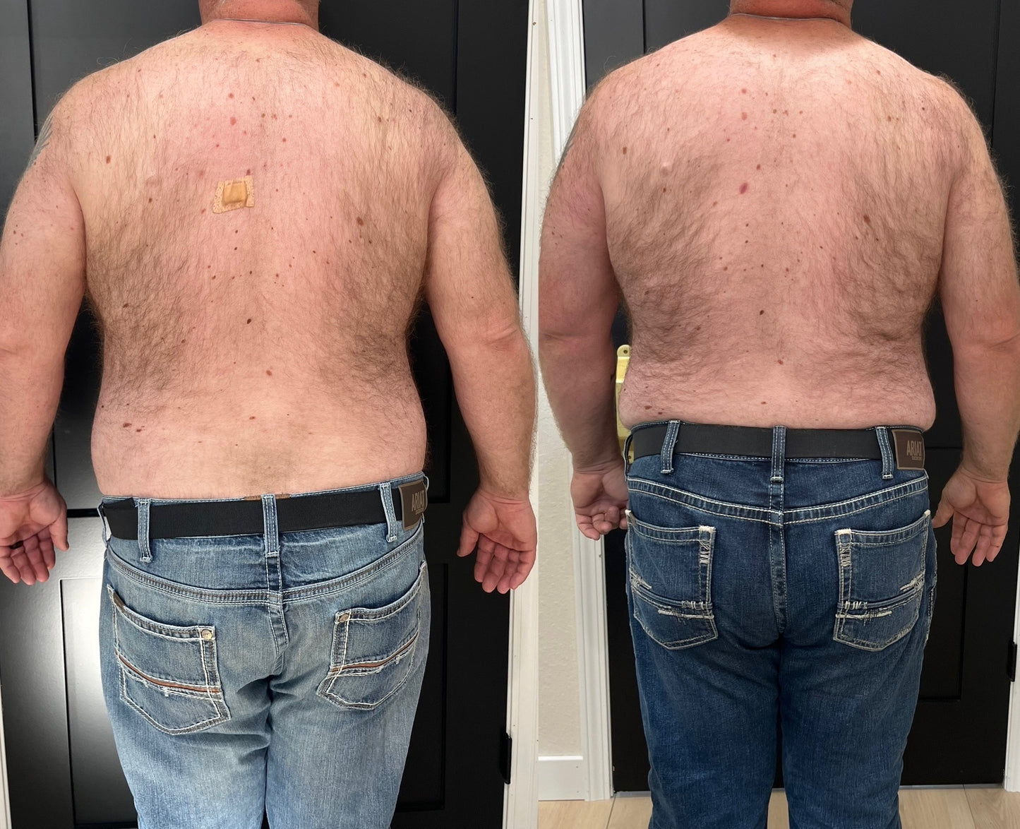 Thinnr- weight loss supplement