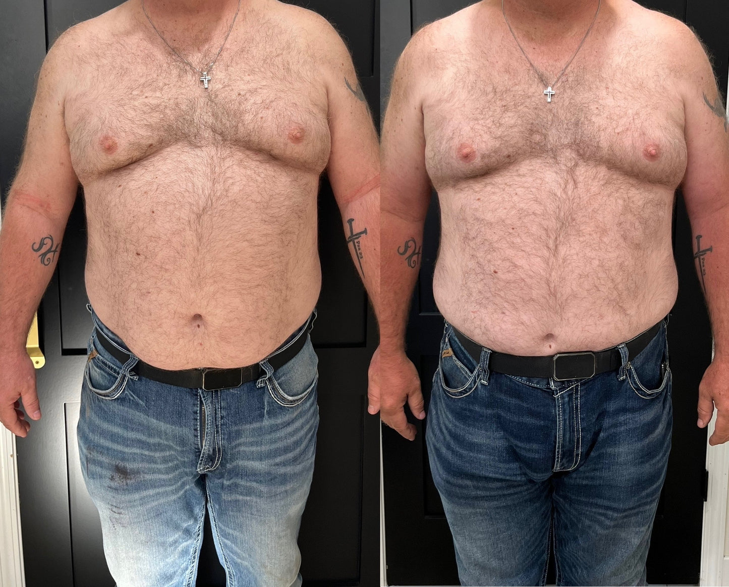 Thinnr- weight loss supplement